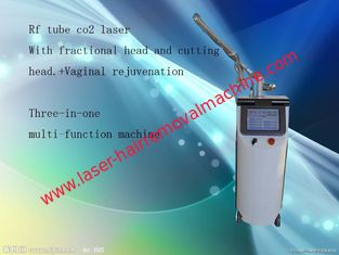 China Warzen-Abbau-Bruchco2-Laser-Ausrüstungs-Grau + weiße Farbe für das Haut-Festziehen fournisseur